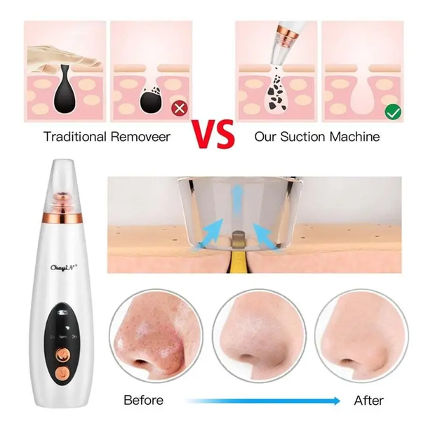 6 In 1 Electric Facial Blackhead Remover Vacuum Suction Cleaning Skin Care Pore Acne Removal Diamond Cleanser Machine White