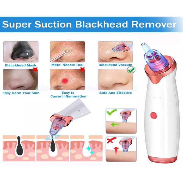 Blackhead Remover Vacuum Usb Rechargeable Electric Suction Facial Acne Extractor Toolcomes With 5 Probes For Female Male Nose