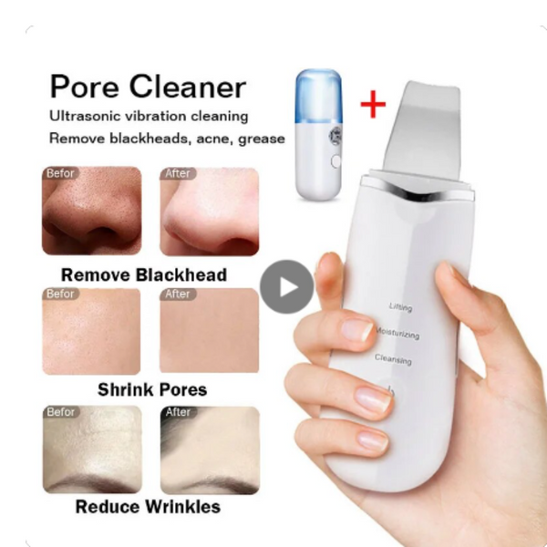 Ultrasonic Ion Deep Clean Skin Scrubber Pore Cleaner Exfoliating Blackhead Remover Rechargeable Facial Cleansing Devices