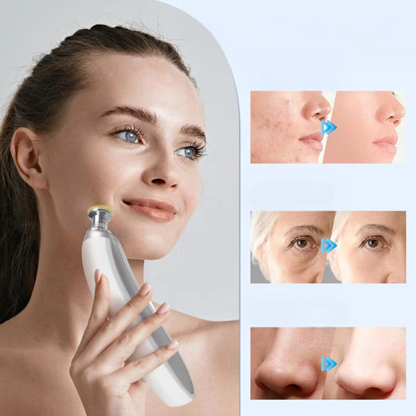 Diamond Microdermabrasion Blackhead Removal Facial Cleansing Device Facial Cleansing Devices