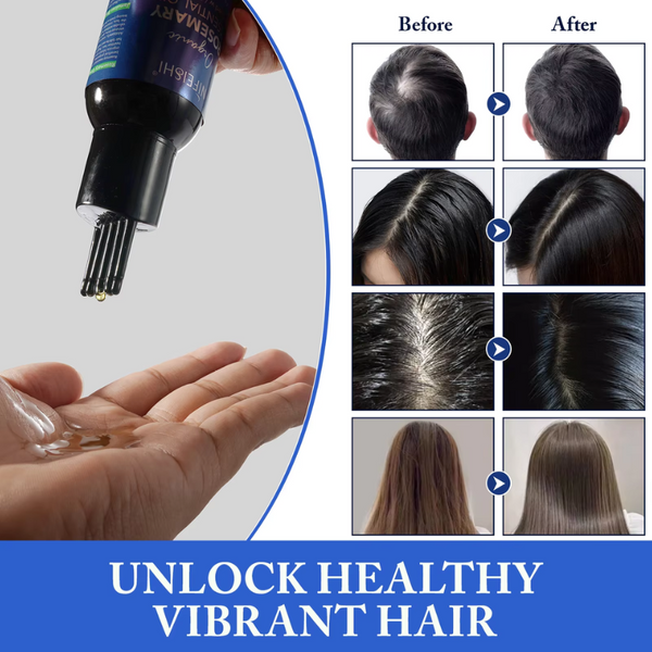 Nifeishi Organic Rosemary Essential Oil 120Ml Massage Oils & Lotions