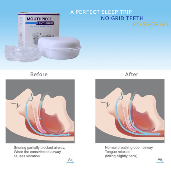 Braces For Anti Bruxism Teeth At Night Temporary Teeth & Supplies