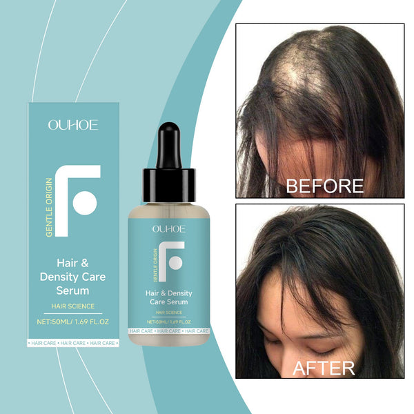 Hair Care Essence, Nourishing Scalp, Hydrating, Soft, Strong And Fragrant Hair Care Essential Oil Sets & Kits