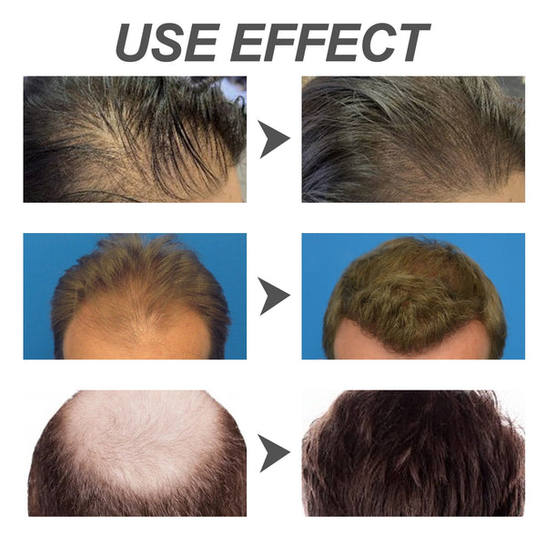 Hair Conditioner, Nourishing Strong Root Clean, Oil Control, Itching And Hair Strengthening Shampoo Sets & Kits