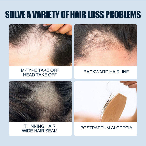 Men's Hair Spray, Dense Hair Solid Hair Hair Line Anti Drop Treatment Fluid Thick Sets & Kits