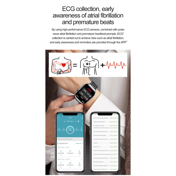 Red Smartwatch With Bluetooth Calling Ecg Blood Pressure Heart Rate Multi Sport Modes Smart Watches