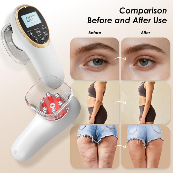 Modern Jingluo Beauty Massager Electric Meridian Facial And Body Roller With Gentle Suction Warmth Multi Speed Skincare Tool For Relaxing Rituals Whit