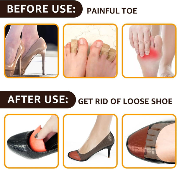 Dr. Scholl's Shoe Filler Inserts Toe Cushions For Better Fit 2 Pairs Orange Round Insoles & Shoe Inserts