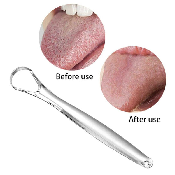 Orku Stainless Steel Tongue Scraper Cleaner Oral Hygiene Reduce Bad Breath Metal Tool Tongue Cleaners