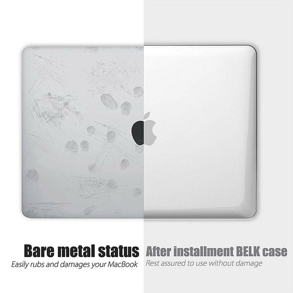 2020 Macbook Pro 13 Inch Case Plastic Hard Shell For A2251 A2289 A2179(Claer) Case Mods Stickers & Decals