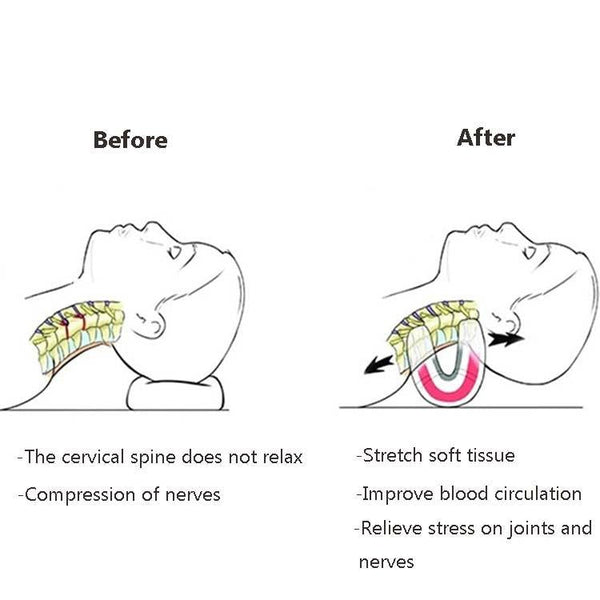 Neck Pillow For Cervical Spine Stretching Massager Orthosis Red Massagers