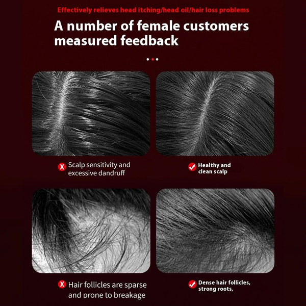 Red Light Scalp Massage Comb For Hair Growth 630Nm Liquid Care Deep Gray Other Massage