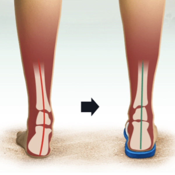 Archline Orthotic Thongs Support Shoes Footwear Flip Flops Orthopedic Blue/White Slippers