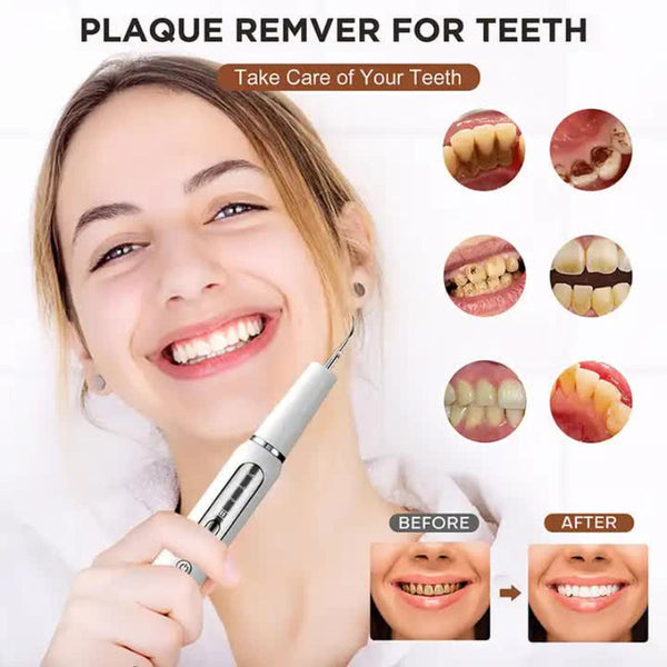 Elosung Black Ultrasonic Dental Cleaner Home Use Plaque Remover Sonic Tooth Stain And Tartar Cleaning Tool Dental Instruments