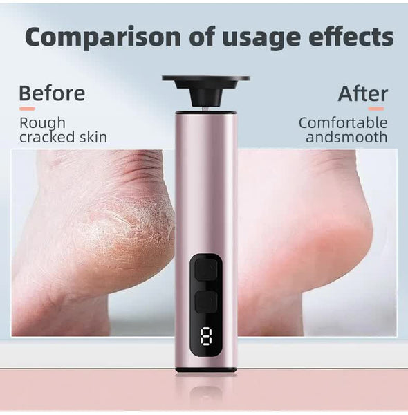 Black Rechargeable Electric Foot File With 9 Speed Settings Callus Remover For Smooth Feet Electric Files & Tools