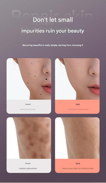 Professional 9 Level Skin Tag & Spot Remover Pen Usb Rechargeable Beauty Device (Blue) Acne & Blemish Control