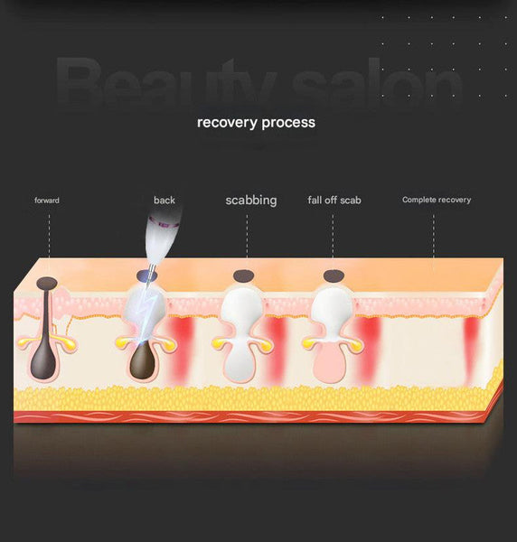 Professional 9 Level Skin Tag & Spot Remover Pen Usb Rechargeable Beauty Device (Silver) Acne & Blemish Control