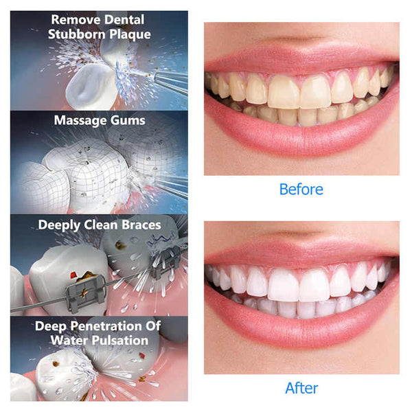 Black Advanced Portable Water Flosser Rechargeable Oral Irrigator Ipx7 Waterproof 4 Cleaning Modes Air & Water Flossers