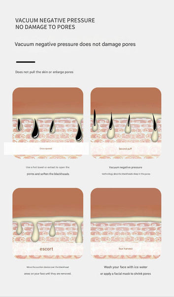 Professional Electric Blackhead Remover Vacuum 3 Modes 4 Suction Heads (Blue) Acne & Blemish Control