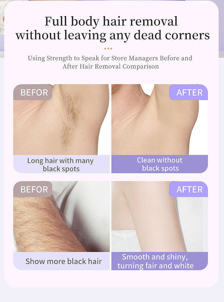 5 In 1 Electric Lady Shaver & Grooming Kit Lcd Display Usb C Rechargeable Full Body Hair Removal (Pink) Women's Shavers