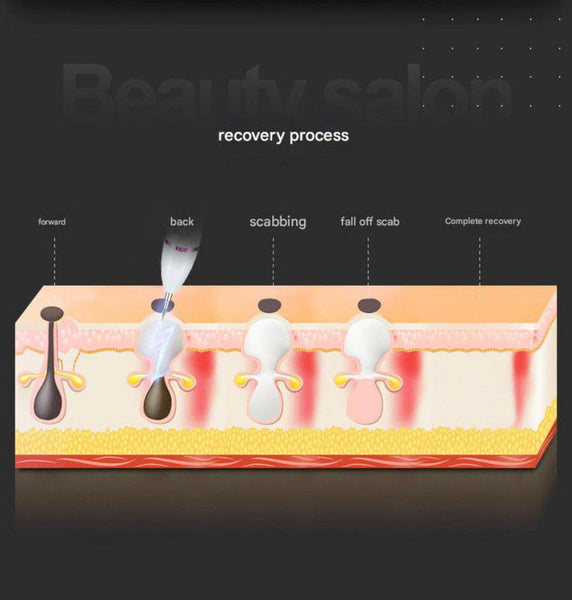 Professional Electric Mole Dark Spot Remover Pen Advanced Plasma Ion Technology For Seamless Skin Tag Freckle Removal Gold Anti Aging Products