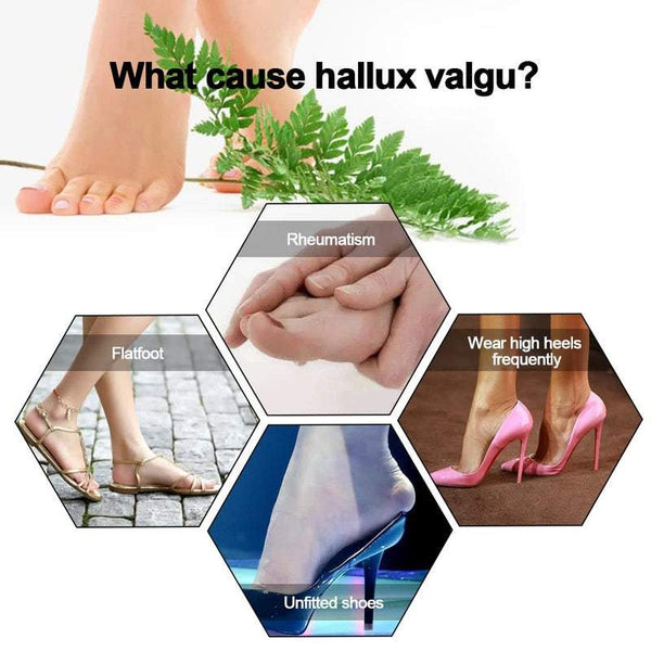Foot Care Big Toes Bunion Hallux Valgus Orthotics Separators Aid Splint Feet Tool Foot Creams & Treatments