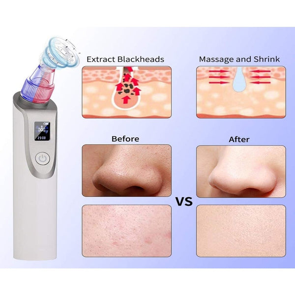 Electric Suction Rechargeable Vacuum Blackhead Remover Facial Cleaner Skin Care Facial Cleansing Devices