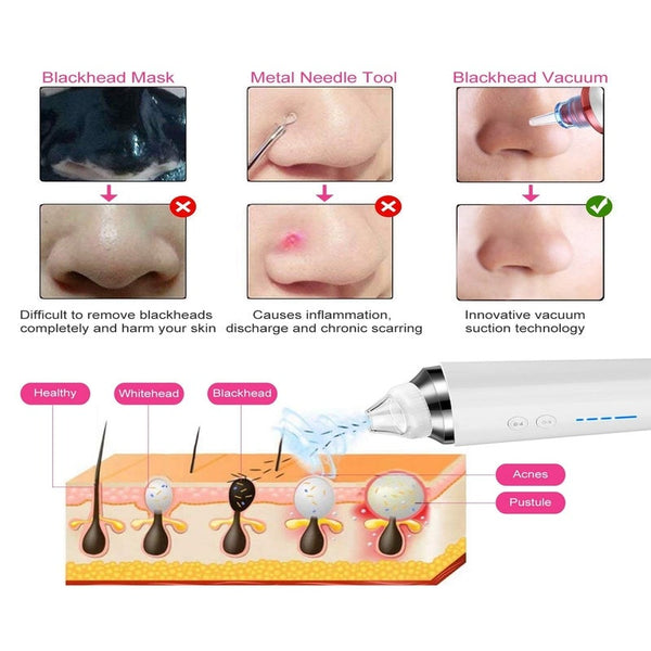 Blackhead Remover Vacuum Wifi 5.0Mp Visual Pore 20X Magnification Usb Rechargeable Electric Suction Facial Acne Extractor Tool Facial Cleansing Device