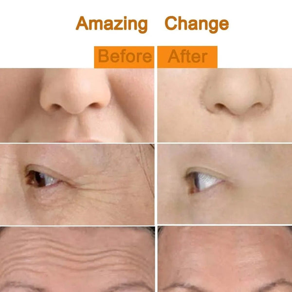 24K Gold Energy Beauty Bar Facial Face Massager 3D Roller Electric Sonic & T Shape Arm Eye Nose Head Lift