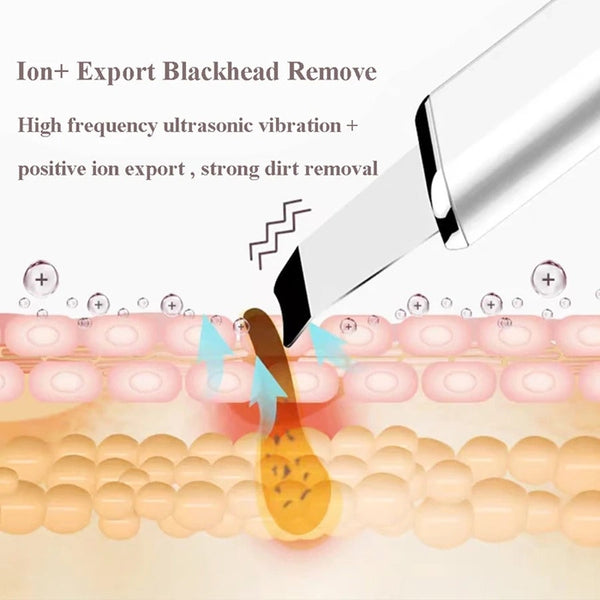 Ultrasonic Skin Scrubber Electric Vibration Deep Face Cleaning Peeling Shovel Pore Cleaner Facial Cleansing Devices