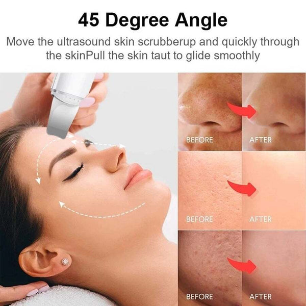 Facial Cleansing Devices Ultrasonic Skin Scrubber Electric Vibration Deep Face Cleaning Peeling Shovel Pore Cleaner