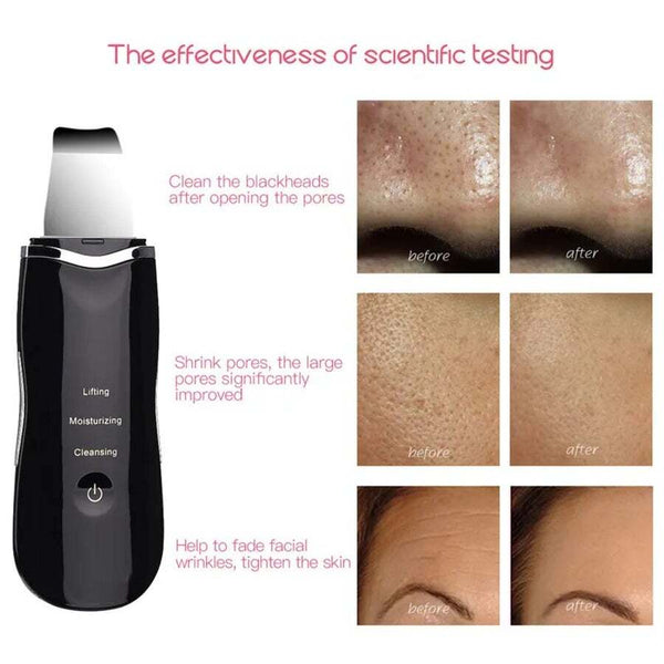 Ultrasonic Skin Scrubber Facial Cleaning Peeling
