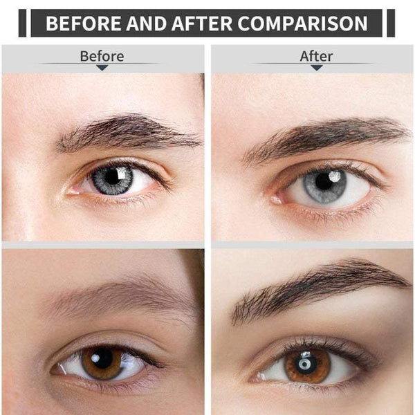 Nose Ear Hair Trimmers Electric Eyebrow Trimming Instrument Rechargeable Remover Painless Precision Razor Tool For Face Lips Facial Removal Clippers &