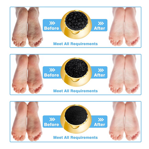 New Electric Pedicure Smooth Machine Callus Remover Usb Charge Foot For Heels Manicure & Pedicure Tools & Kits