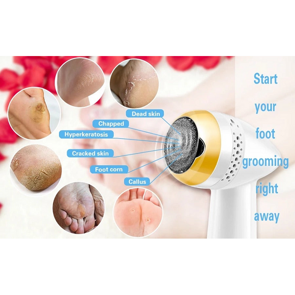 New Electric Pedicure Smooth Machine Callus Remover Usb Charge Foot For Heels Grinder Files Absorbing Portable Clean Care