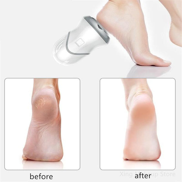 Usb Rechargeable Foot Massager Dry Heel Callus Remover Smoother Sander With Vacuum