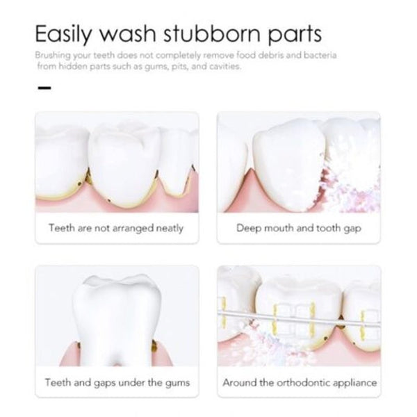 Oral Irrigator Water Flosser Pick Dental Jet Usb Rechargeable Air & Water Flossers