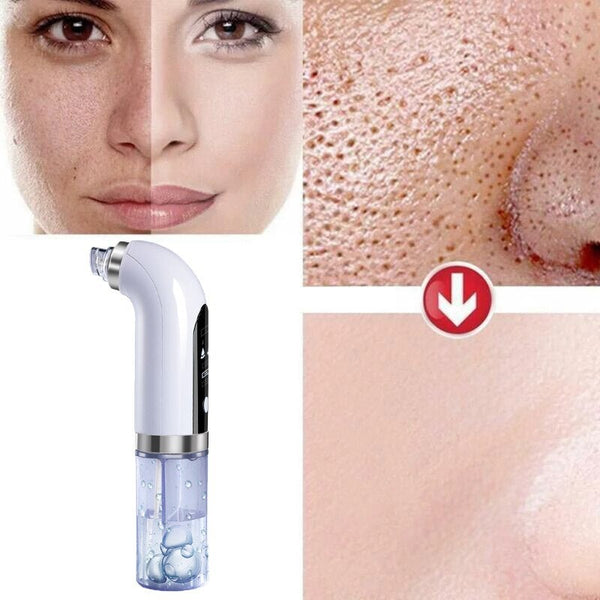 Upgrade Design Powerful Suction Reliable Technology Multifunctional Professional Facial Cleansing Devices