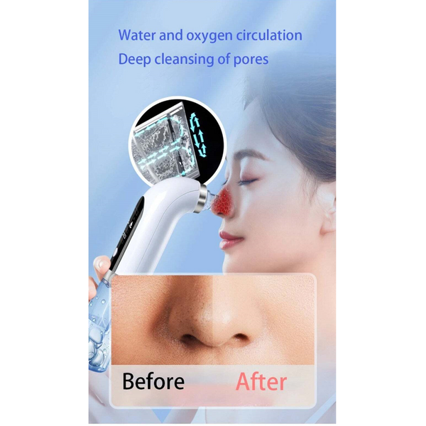 Upgrade Design Powerful Suction Reliable Technology Multifunctional Professional Facial Cleansing Devices
