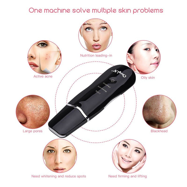 Ultrasonic Skin Scrubber Facial Cleaning Peeling Device Facial Cleansing Devices